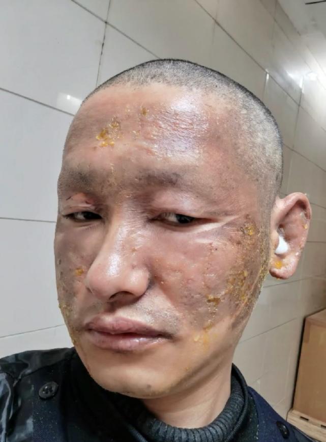 探索星光的奧秘，明星天臉重塑魅力的奇跡之旅