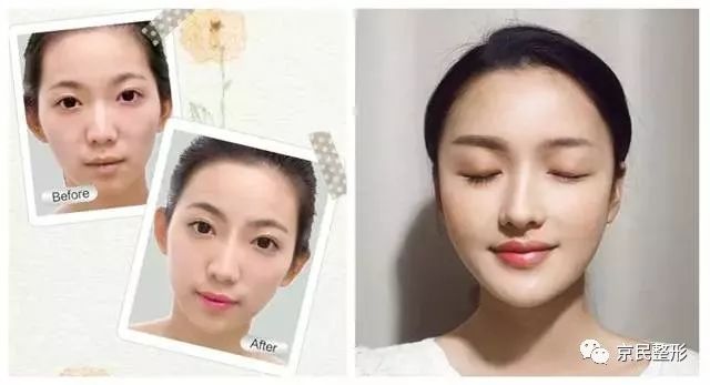 最新眉部美容技術(shù)，塑造完美眉型，瞬間驚艷全場的美顏秘訣 ???