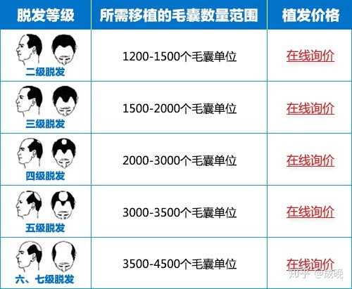 種頭發(fā)的價(jià)格之旅，探尋價(jià)格與自然的浪漫遨游