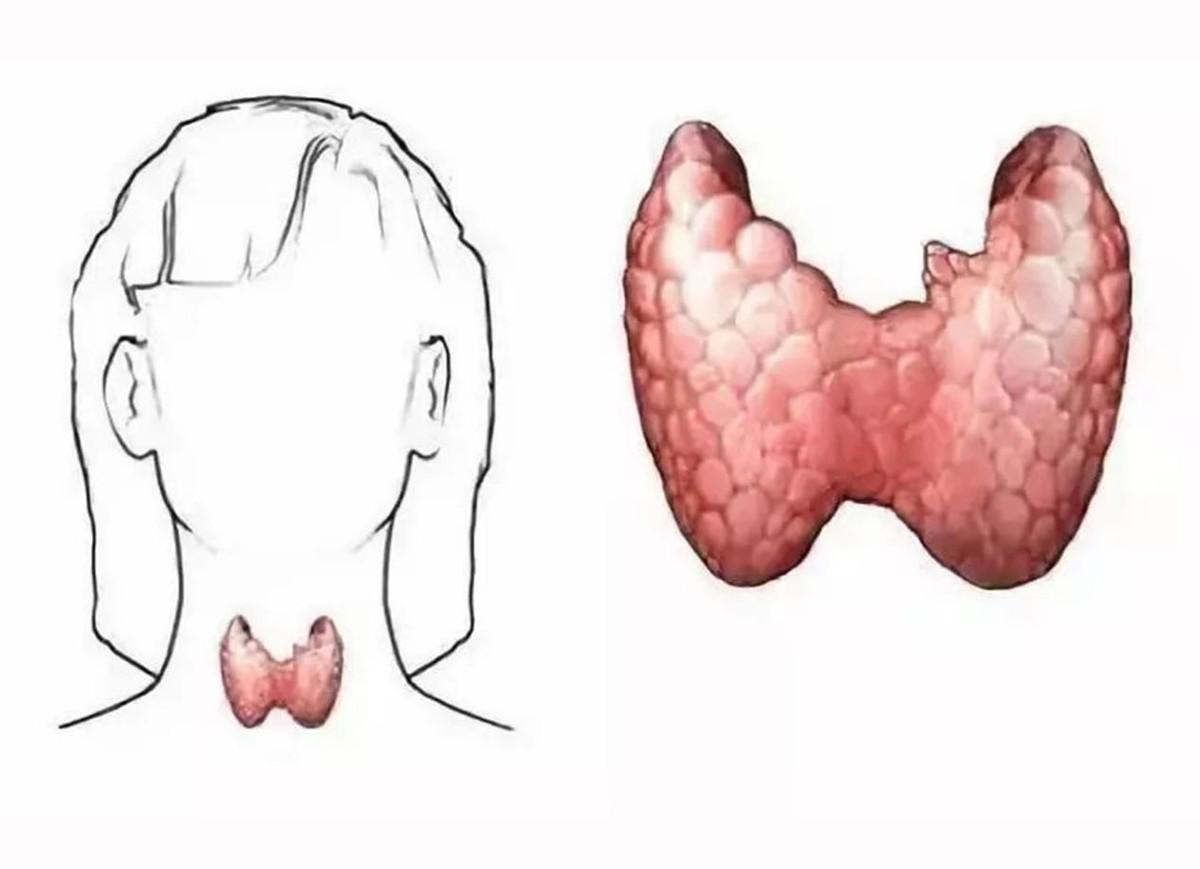 最新甲狀腺檢查步驟指南，詳細(xì)步驟解析